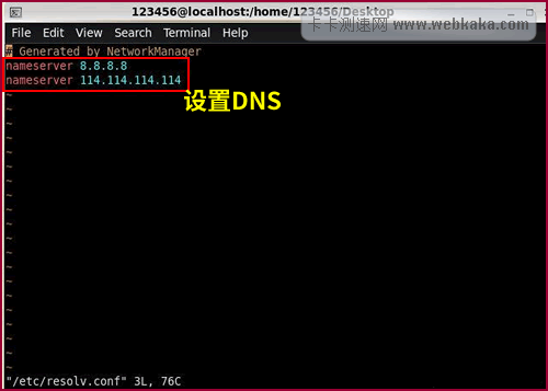 Linux设置DNS